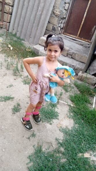 Balaca Məryəmin anası: "Atası xəstəliyini öyrəndiyi gün bizi tərk etdi, əməliyyata imkanımız çatmır" - FOTO