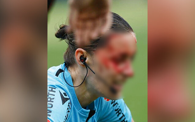 Hakim kamerayla toqquşub, ağır zədə aldı - Fotolar