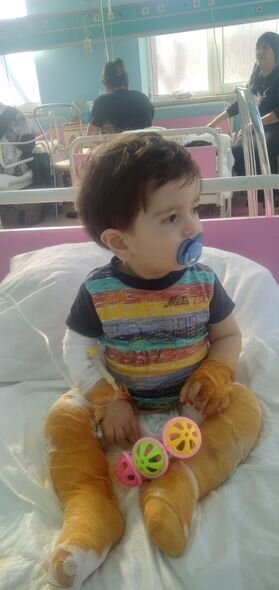 Bədəni yanan bir yaşlı Ömərin dəstəyə ehtiyacı var - FOTO