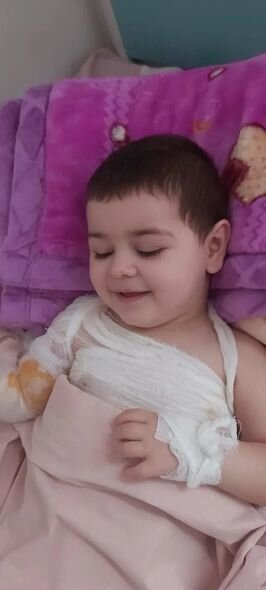 Üzərinə qaynar qazan aşıran Nərminin anası fəryad edir: "Evimizə qayıtmaq üçün borc pul almışıq" - FOTO