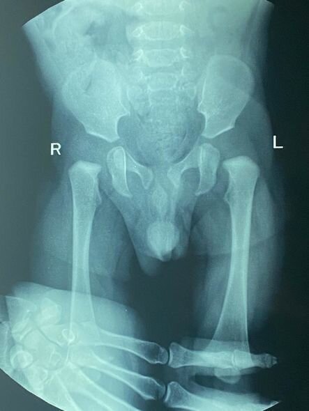 Körpə Zeydin müalicəyə ehtiyacı var: "Maddi cəhətdən tam tükənmişik" - FOTO