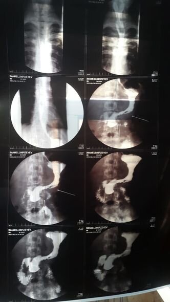 Üç övladı olan İmamalının dəstəyə ehtiyacı var: Müalicələri yarım qalıb - FOTO