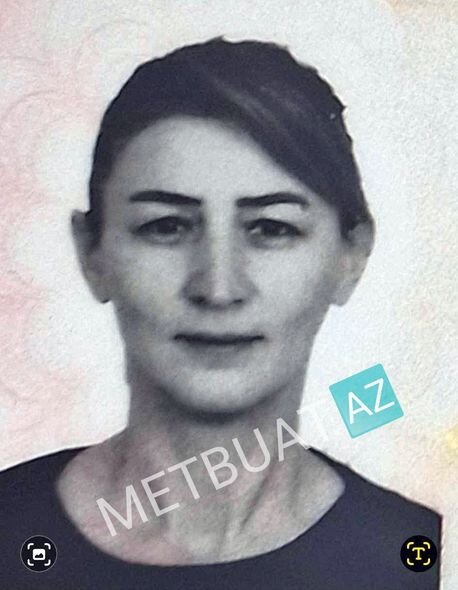 Həkimin arvadını döyən sevgilisinə qadağa qoyuldu - FOTO