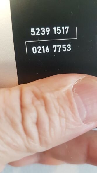 Düşdüyü qəzadan sonra yatağa məhkum olan Şahnazın dəstəyə ehtiyacı var - FOTO