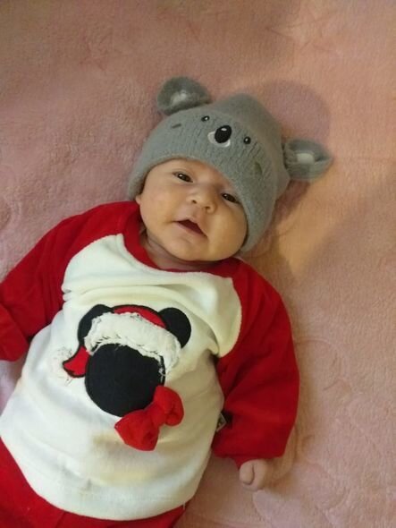 Nurayın dəstəyə ehtiyacı var: Əməliyyat üçün 850 manat çatmır - FOTO