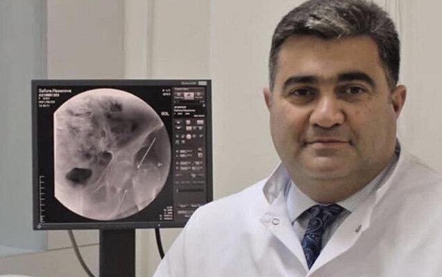 Aydın Əliyev işdən çıxarıldı