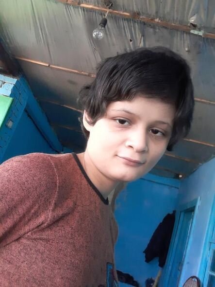 İki ağır xəstəliyi olan Zəhranın anası: "Epilepsiyası tutanda qorxuram geri qaytara bilməyim" - FOTO/VİDEO