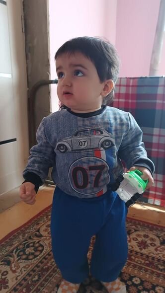 İki yaşlı Raulun anası: "Gün ərzində 3-4 dəfə epilepsiyası tutur" - FOTO