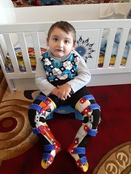 Hər addımı əzabla atır: Altı yaşlı Tunarın sizin köməyinizə ehtiyacı var - FOTO/VİDEO