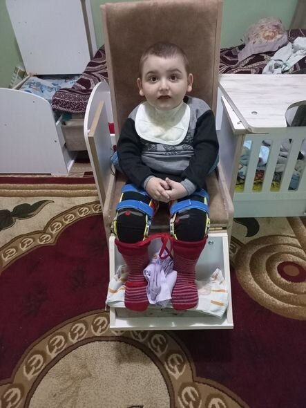 Hər addımı əzabla atır: Altı yaşlı Tunarın sizin köməyinizə ehtiyacı var - FOTO/VİDEO