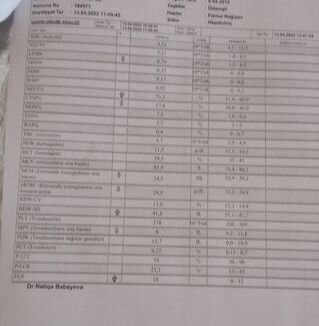 Evlərini, maşınlarını satıb Laləni əməliyyat etdirdilər: "Müalicə üçün dəstəyə ehtiyacları var" - FOTO