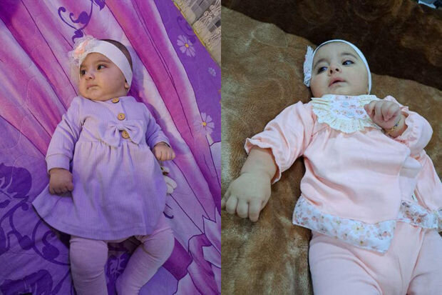 Bir yaşlı körpənin dəstəyə ehtiyacı var: "Vəziyyəti günü-gündən ağırlaşır" - FOTO