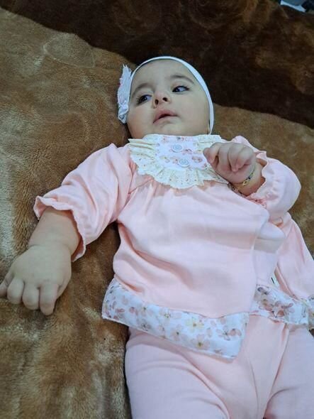 Bir yaşlı körpənin dəstəyə ehtiyacı var: "Vəziyyəti günü-gündən ağırlaşır" - FOTO