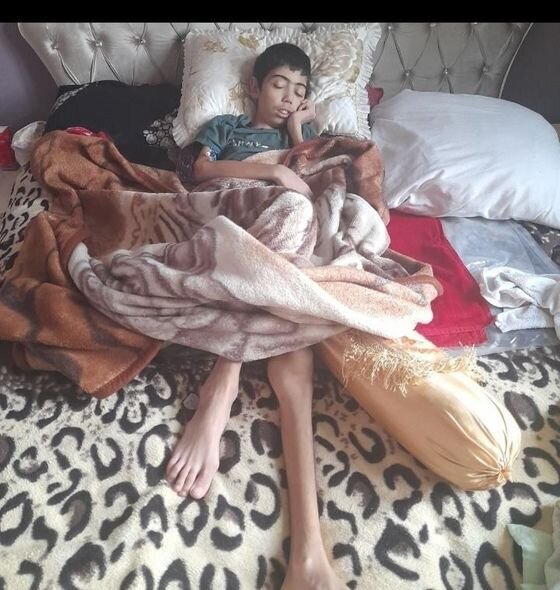 17 yaşlı Röyalın dəstəyə ehtiyacı var - FOTO