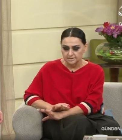 "Toppuş bacı"dan boşanma xəbərlərinə cavab - Fotolar