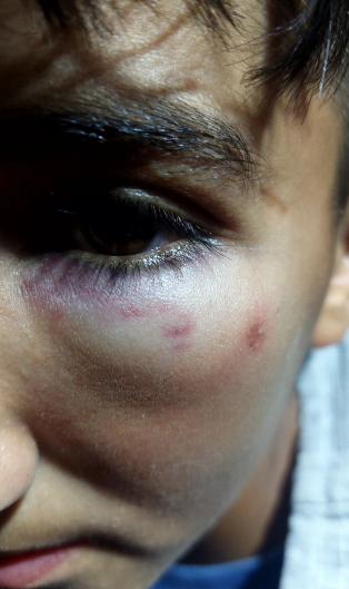 Biləsuvarda 8-ci sinif şagirdinin döyülməsi iddiası ilə bağlı RƏSMİ AÇIQLAMA