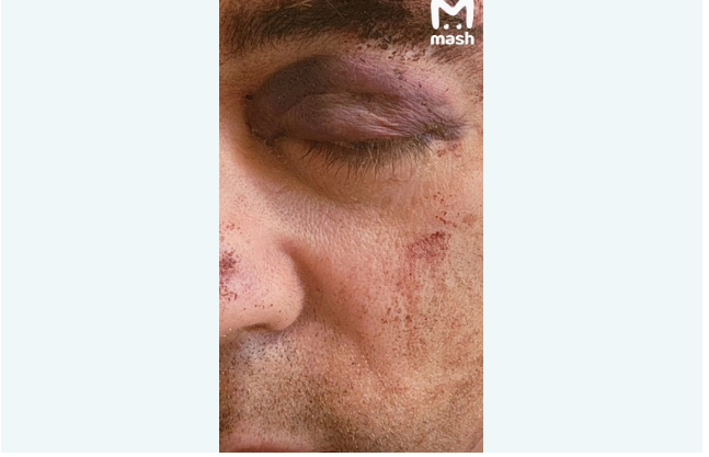 Armen Ciqarxanyanın oğlu ABŞ-da güllələnib