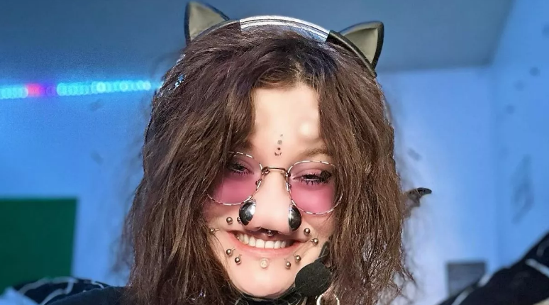 Uşaqlar onu görəndə QAÇIRLAR: Burun dəliklərini böyüdərək rekord QIRMAQ İSTƏYİR