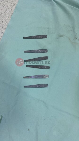 Bakıda bir nəfər 9 ədəd qaşıq uddu (FOTO)