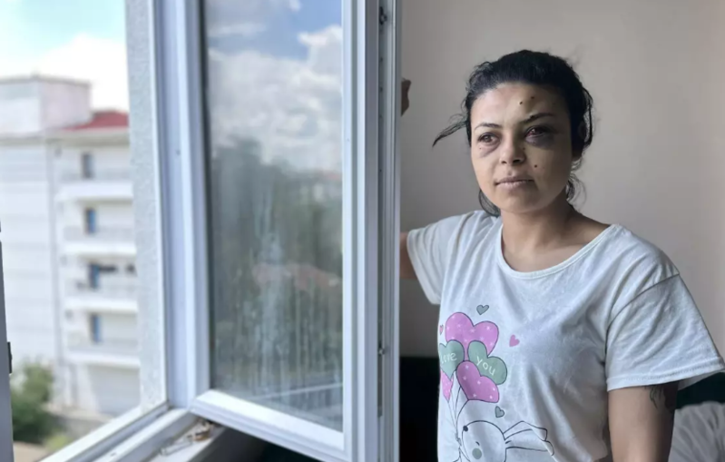 Pəncərədən toya baxarkən gözündən oldu: "Həyatım bitdi"