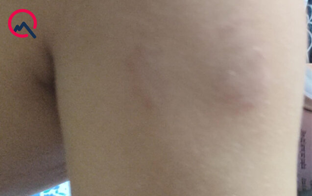 Xüsusi məktəbdə müəllim azyaşlıya şiddət göstərib? - Rəsmi açıqlama - Foto