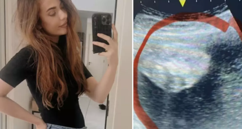 Hamilə olduğunu düşündü, lakin bədxassəli şişlə qarşılaşdı