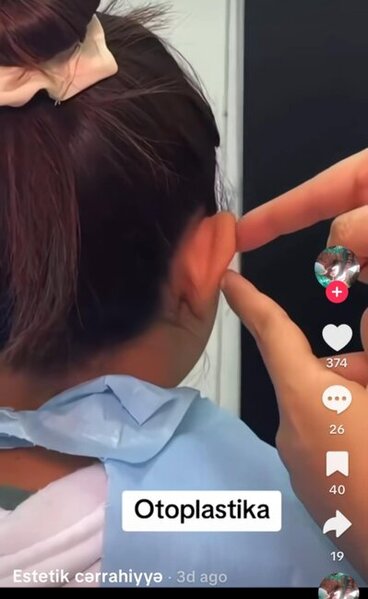 Dr.Ella necə estetik əməliyyatlar icra edir? -Araşdırma