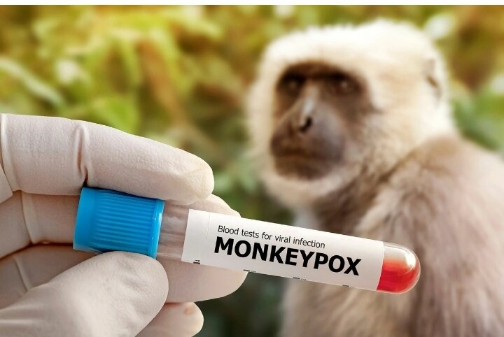 Meymunçiçəyi nəzarətdən çıxır: Afrika epidemiya astanasında