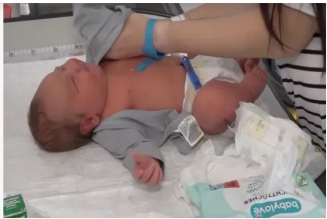 Çexiyada 25 yaşlı qadının doğduğu uşaq hamını TƏƏCCÜBLƏNDİRDİ