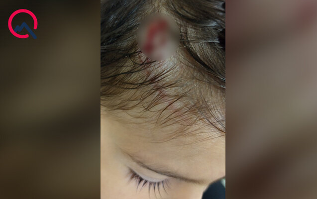 Masazırda 2 yaşlı uşağı it dişlədi - Fotolar