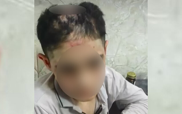 14 yaşlı yeniyetmə səhiyyə müəssisəsinə yerləşdirildi