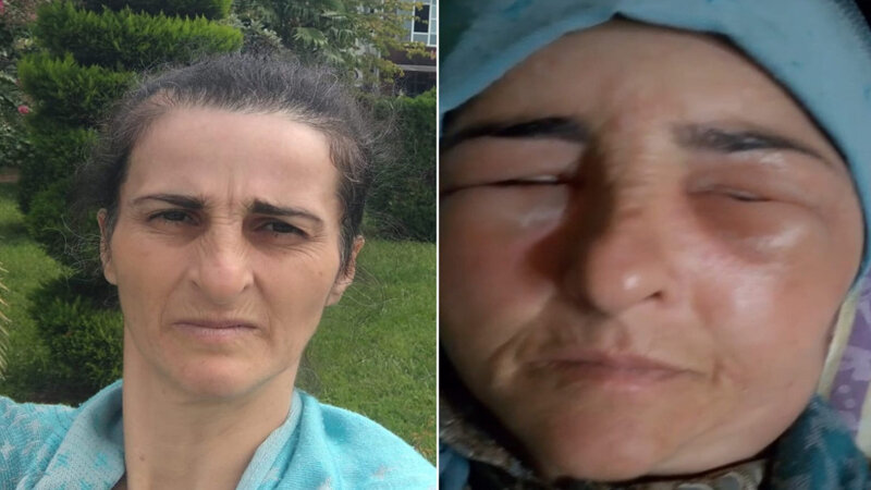 ​​​​​​​Lənkəranda qonşular arasında dava olub, xəsarət alan var