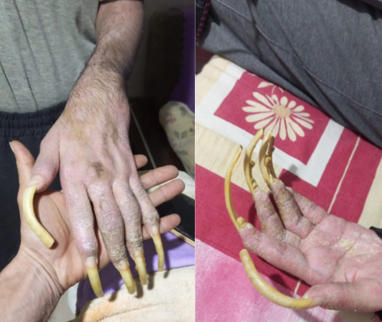 Telefon asılılığı olan gənc: "Əlimdə olsa nə tualetə gedərəm, nə də yemək yeyərəm" - FOTO