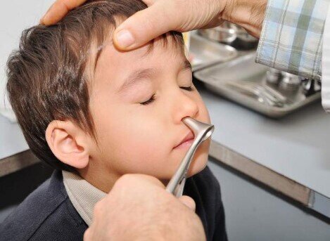 Burun əməliyyatı üçün 18 yaşı gözləmək lazım deyil – Uşaqlar üçün erkən müdaxilə vacibdir