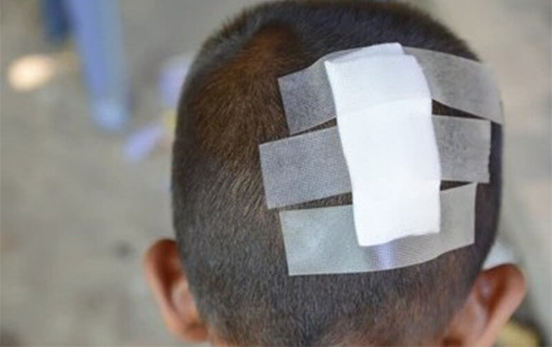 Hesaba görə kafe sahibi ilə mübahisədə - 6 yaşlı oğlu başından zərbə aldı