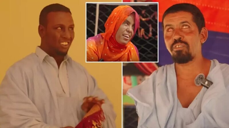 Bu kənddə hər kəs kor doğulur - FOTO