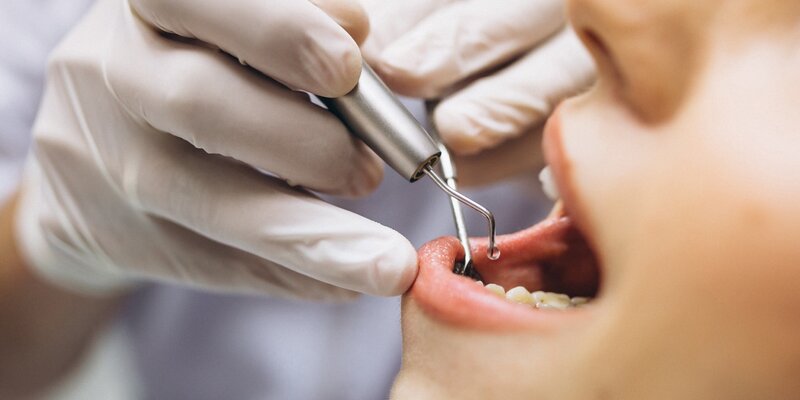 "Arash Estetic"dən şikayət: Qadın sağlam dişlərini də itirib? (VİDEO)