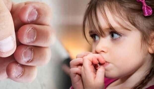 Uşaqlarda bu davranışların arxasındakı psixoloji səbəblər nədir? - AÇIQLAMA