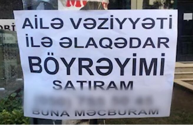 Pula görə orqanlarını satmaq istəyirlər: Yalnız bu halda MÜMKÜNDÜR