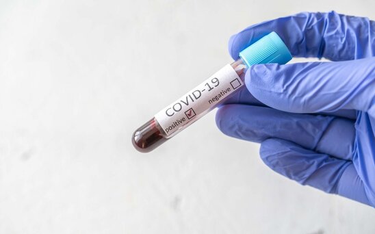 Azərbaycanda daha 630 nəfər koronavirusa yoluxub