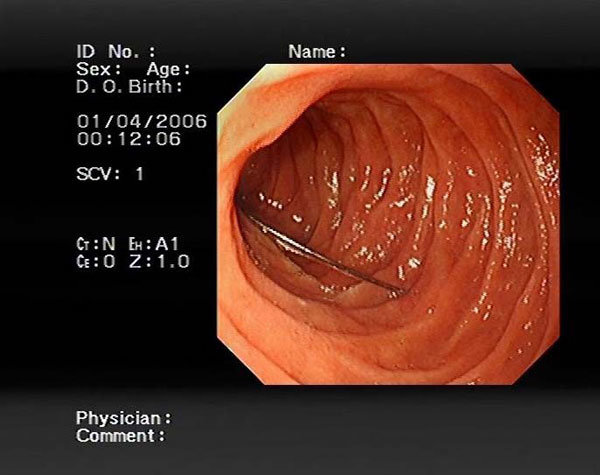 15 iynə udan Hülya qarın ağrısı səbəbilə həkimə getdi, eşitdiklərindən dəhşətə gəldi - FOTOLAR+VİDEO
