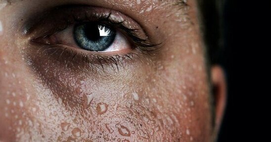 Çox tərləmə bu gizli xəstəliklərdən - Xəbər verir