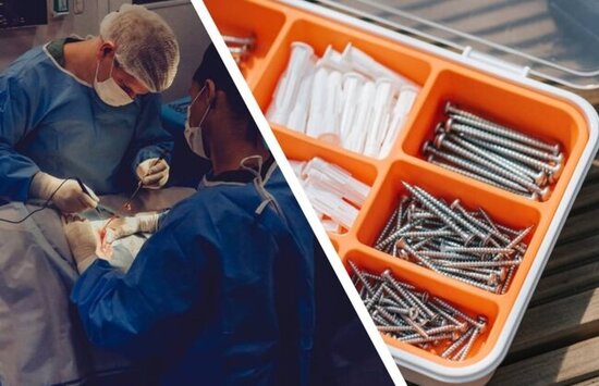 Həkimlər ŞOKDA: Mədəsindən 1 kilo mismar çıxdı - FOTO