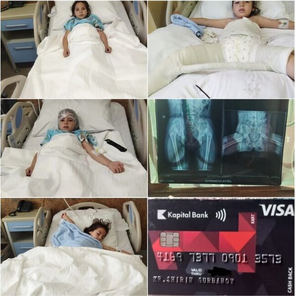 Balaca Aytəndən ŞAD XƏBƏR: Əməliyyat olundu - FOTO-VİDEO