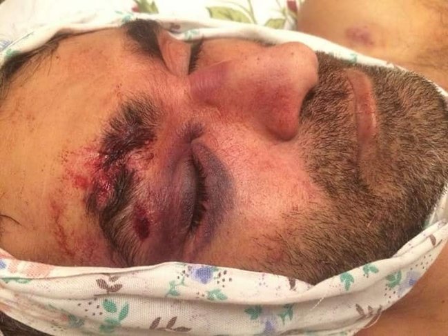 Vətəndaşı polis bölməsinə çağırıb döyüb öldürdülər - Şok İDDİA - VİDEO+FOTOLAR