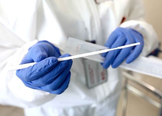 TƏBİB: "Koronavirus testlərinin qiymətlərinə qarışmırıq"