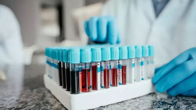 "Qızıl qan": Dünyada cəmi 50 nəfərdə olan ən nadir qan qrupu niyə vacibdir?