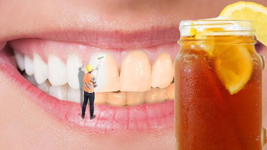 Dişlərinizin rəngini dəyişən 7 ÜSUL