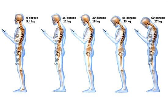 Ayaqaüstə əldə telefon tutmağın zərərləri