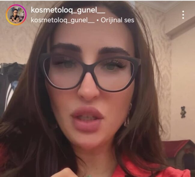 "Kosmetoloq" Günel Muxtar necə inyeksiya prosedurlarını həyata keçirir? -Araşdırma